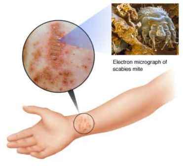 causes of body itch