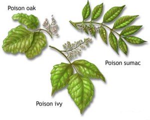 poison ivy body itch