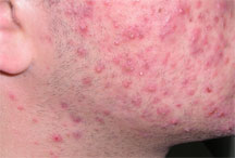 red spots on skin