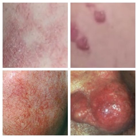 red spots on skin pictures