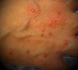 small red dots on skin